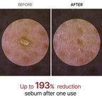 Dr.Melaxin - Peel Shot Glow Rice Ampoule Duo (Black + White)