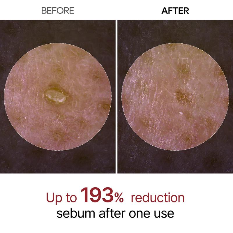 Dr.Melaxin - Peel Shot Glow Rice Ampoule Duo (Black + White)