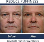 Men Eye Cream Anti Aging,Himse Awaken Peptide Depuffing Eye Gel