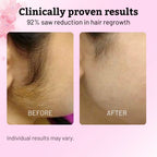 Caramela Beauty Cyperus Rotundus Oil for Natural Hair Reduction - 60ml/2oz