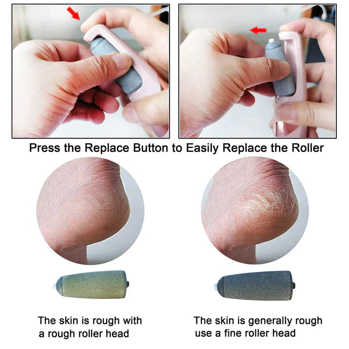 ELECTRIC PEDI CALLUS REMOVER