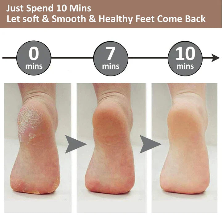ELECTRIC PEDI CALLUS REMOVER