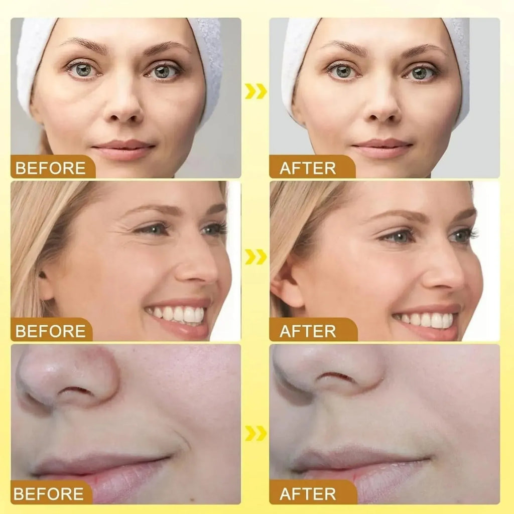TLOPA® Botox Bee Venom Firming Serum Stick