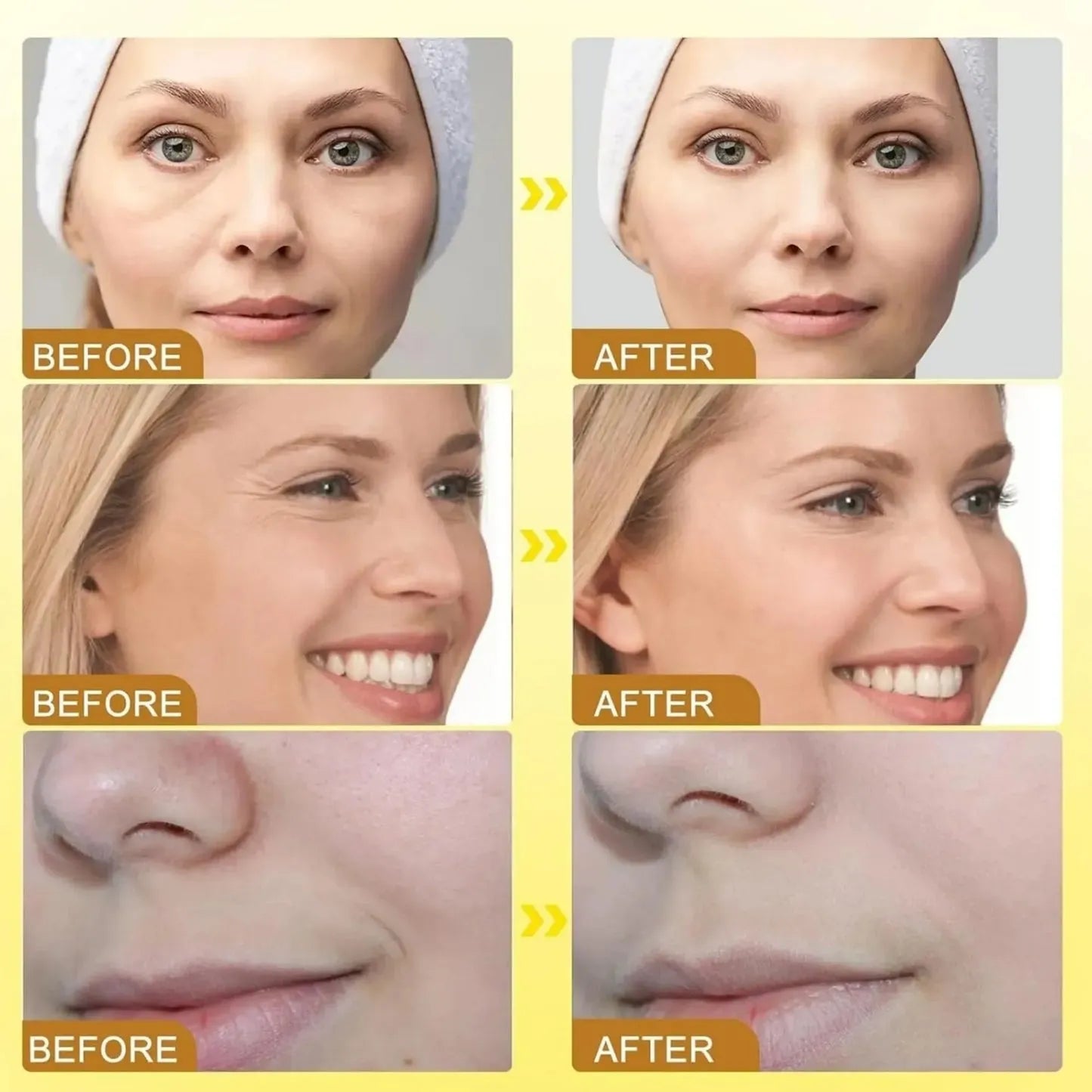 TLOPA® Botox Bee Venom Firming Serum Stick