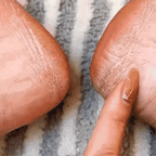 ELECTRIC PEDI CALLUS REMOVER