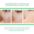 Herbal Exfoliating Gel - Skin Moisturizing Exfoliating Gentle Cleansing Gel Deep Brightening Gel