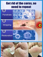 【Apply and peel】Corn remover